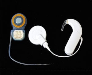 Tiny Interconnect Products Bring Sound to Life - Cochlear Implant Connectors